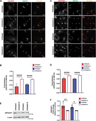 GARP dysfunction results in COPI displacement, depletion of Golgi v-SNAREs and calcium homeostasis proteins